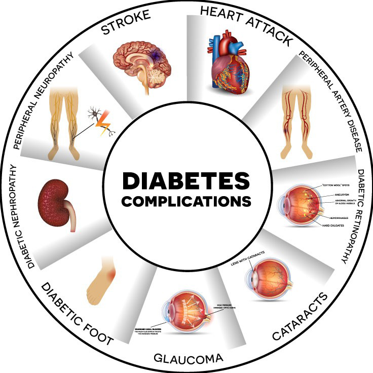 Diabetes Complication Chart from Tennessee Department of Health Project Diabetes website