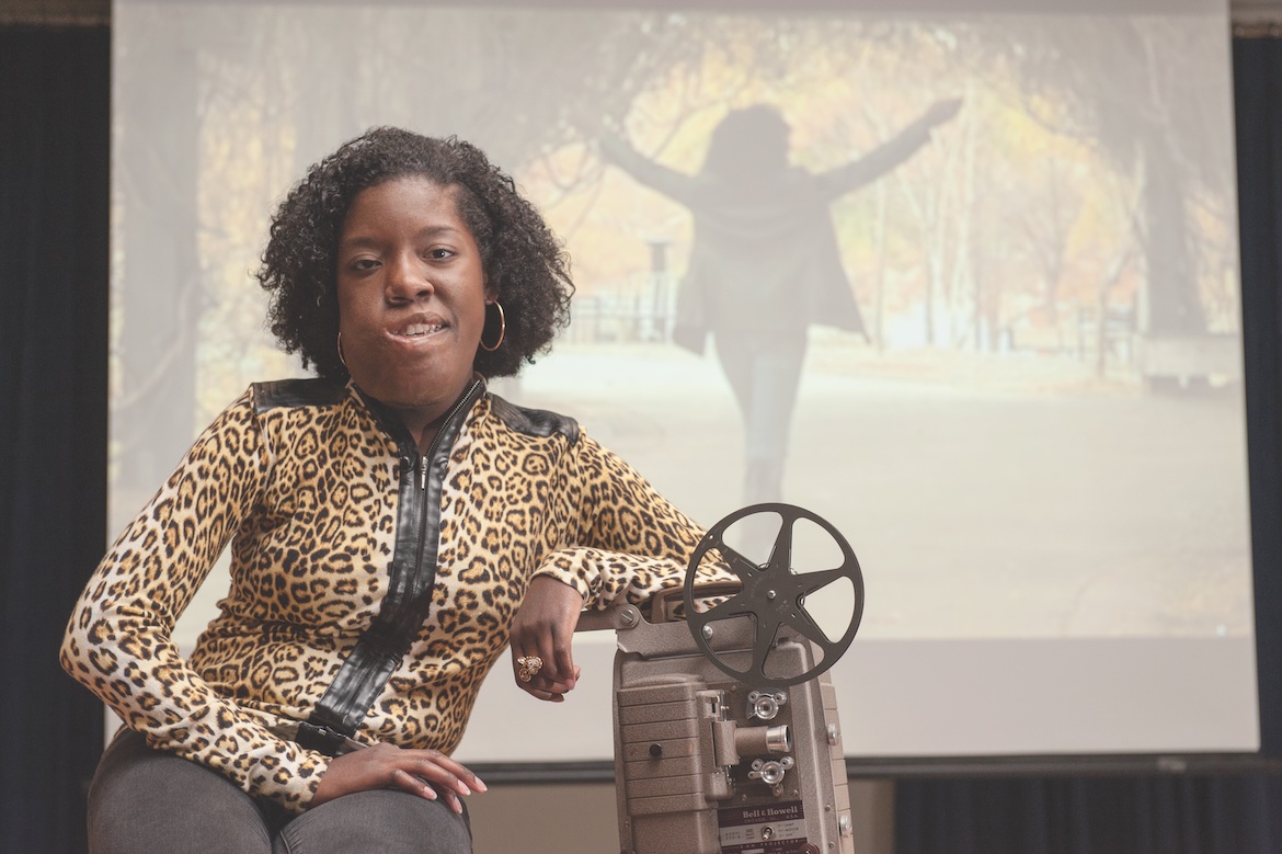 MTSU Honor's College Journalism alumni Jasmine Gray featured for her film work on "More than Skin Deep" documenting her struggle with Arteriovenous Malformation to raise awareness of the rare disorder.